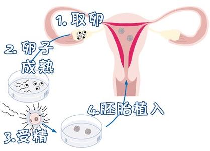 严重少弱精